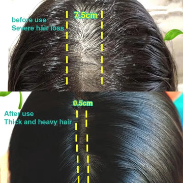 Fast Ginger Hair Growth Spray for Root Regrowth & Scalp Repair – Anti Hair Loss Serum