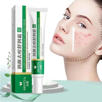 Herbal Acne Treatment Cream for Scar & Blackhead Removal, Oil Control & Pore Shrinking