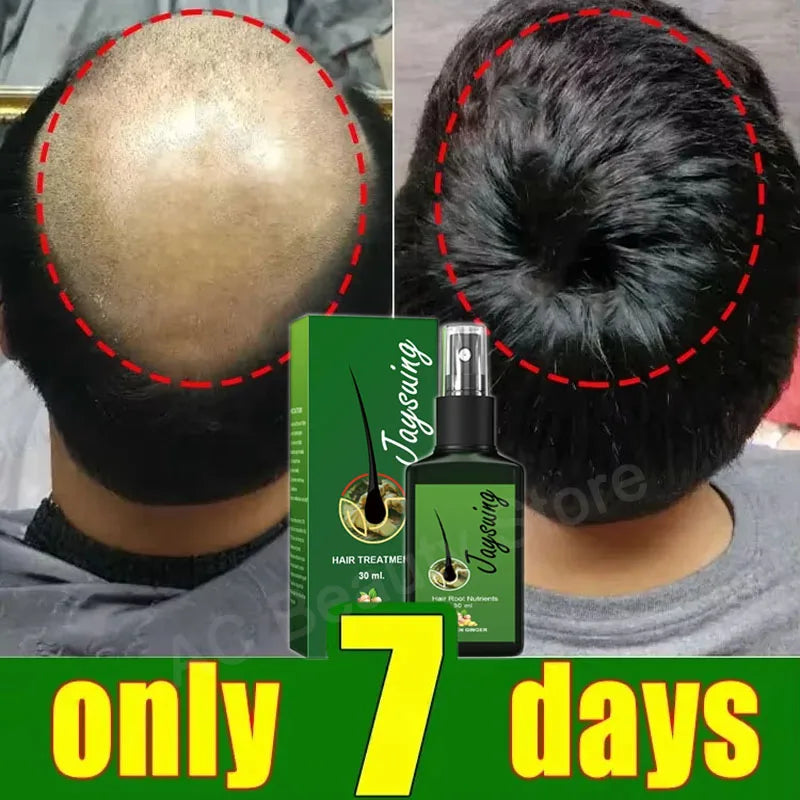 Fast Ginger Hair Growth Spray for Root Regrowth & Scalp Repair – Anti Hair Loss Serum